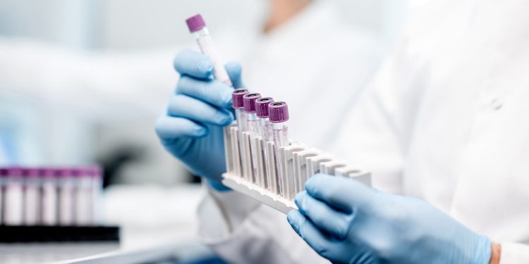 Pharma Giant Trials IBM Blockchain in Bid to Improve Clinical Trials