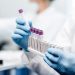 Pharma Giant Trials IBM Blockchain in Bid to Improve Clinical Trials