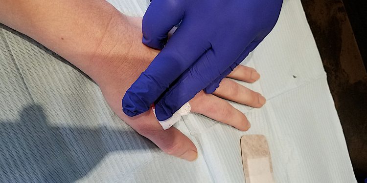 I Got the Mark of the Beast – And It’ll Hold My Bitcoin